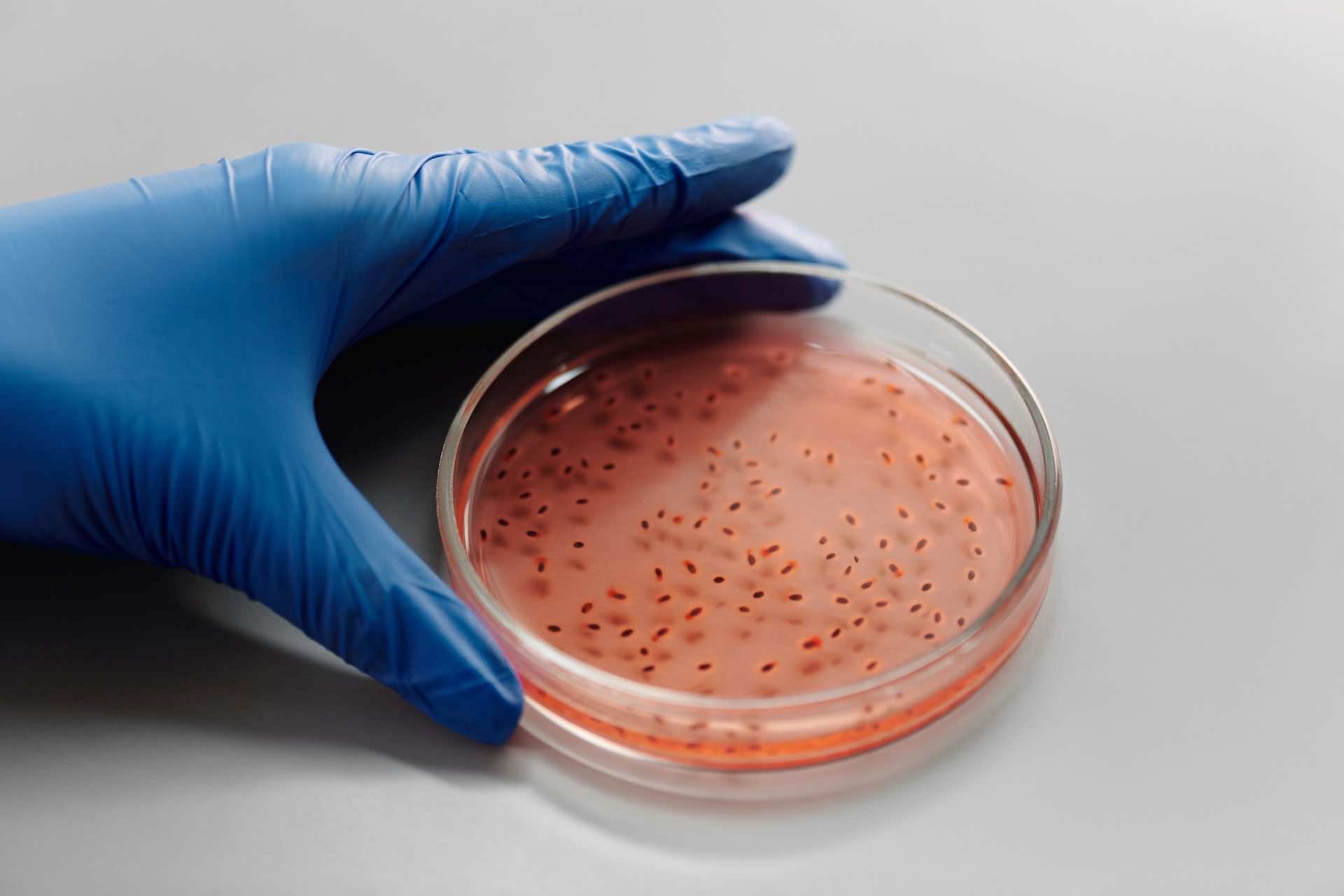 Akkermansia und Next-Generation-Probiotika: Natürliche Lösungen für chronische Krankheiten